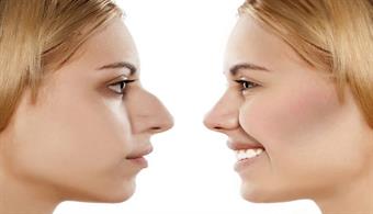 جراحی پلاستیک صورت چیست؟