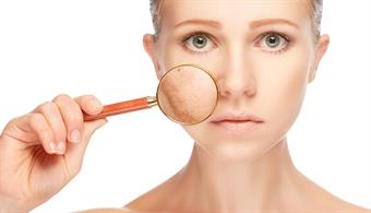 آکنه چیست؟ علل بروز و راه‌های درمان آن کدامند؟